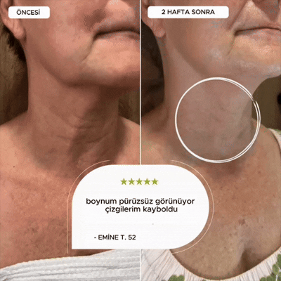 Cilt Gençleşme Seti